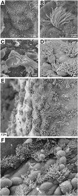 Pathogenesis of Neisseria gonorrhoeae and the Host Defense in Ascending Infections of Human Fallopian Tube